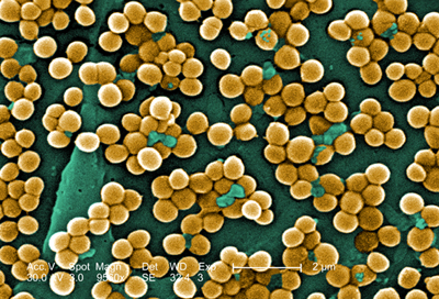 Methicillin-resistant Staphylococcus aureus (MRSA): This 2005 scanning electron micrograph (SEM) depicted numerous clumps of methicillin-resistant Staphylococcus aureus bacteria, commonly referred to by the acronym, MRSA; Magnified 9560x. Methicillin-resistant Staphylococcus aureus (MRSA) is a type of bacteria that is resistant to certain antibiotics. These antibiotics include methicillin and other more common antibiotics such as oxacillin, penicillin, and amoxicillin. Serious or life-threatening occurrences of "Staph" infections, including MRSA, occur most frequently among persons in hospitals and healthcare facilities (such as nursing homes and dialysis centers) who have weakened immune systems.  Photograph by Janice Haney Car courtesy of CDC